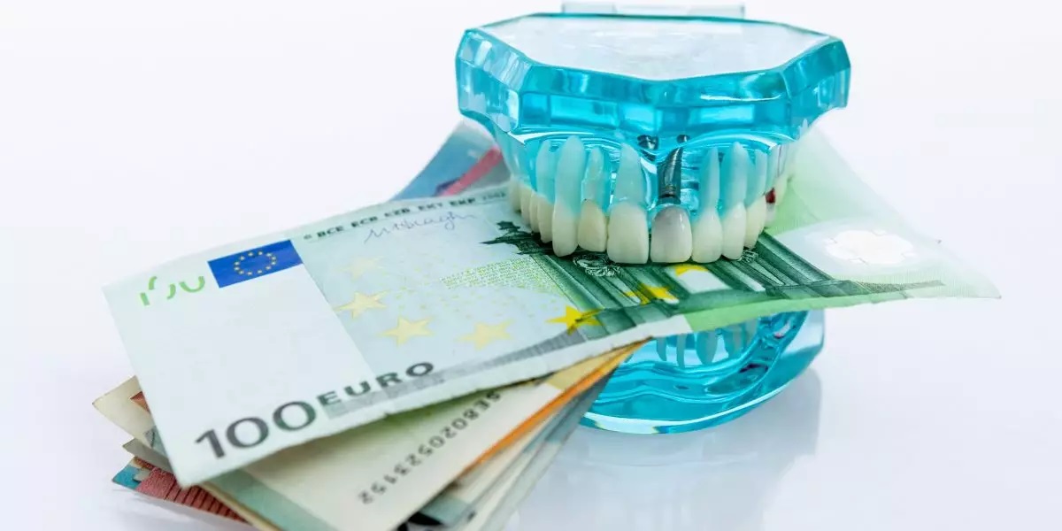 Kiefermodell mit Gelscheinen steht für Zahnimplantat-Kosten