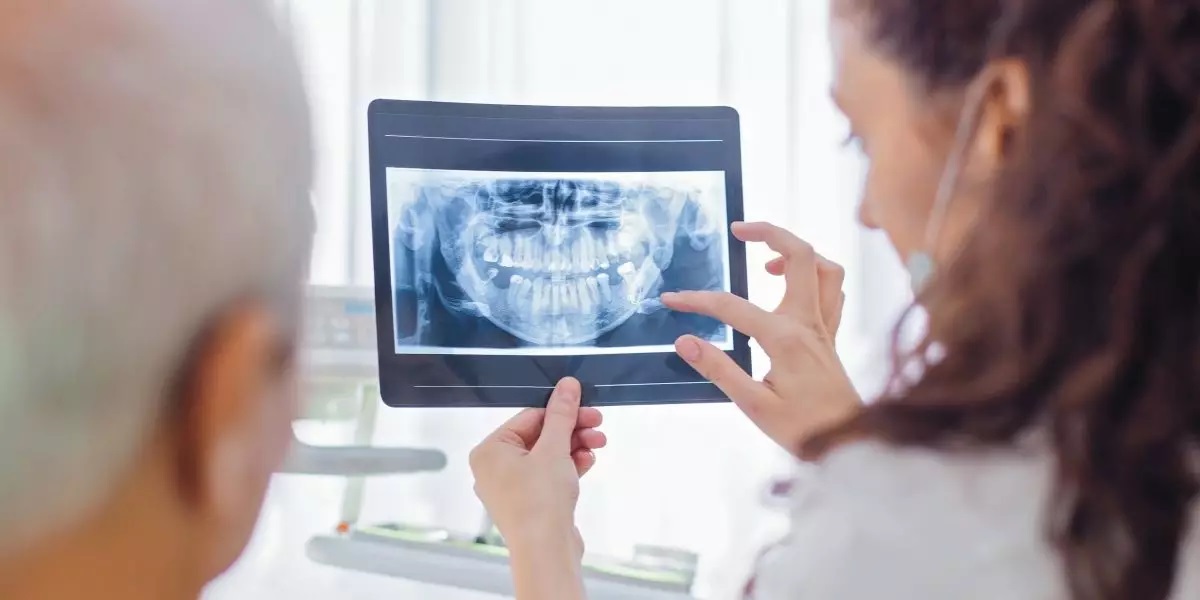 Ob ein Zahnimplantat gefährlich wäre, untersucht die Zahnärztin am Röntgenbild.